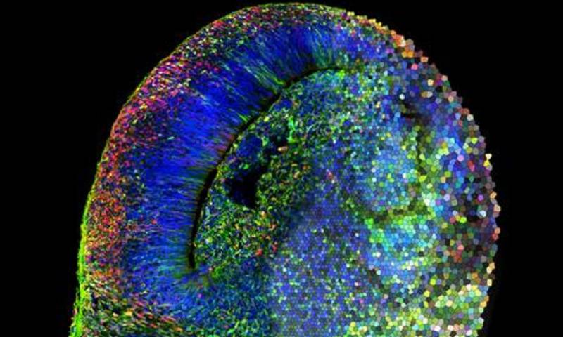 El punto de partida de la investigación es un organoide cerebral, la versión milimétrica del cerebro humano fabricada, mediante métodos de cultivo celular, en el laboratorio/ Foto: cortesía EFE